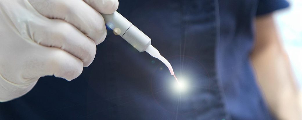 Laserbehandlung Parodontitis